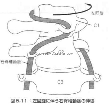 首の曲がりで血流悪くなる