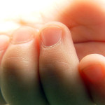 爪の甘皮を処理してもすぐできる人、原因は内臓の疲れ