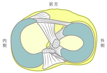 円盤状半月　引用