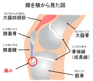 骨端線　引用