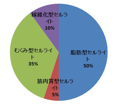 セルライト4つのパターン