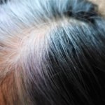 白髪は抜くべきか抜かぬべきか、中医学から診る３つの分類分け