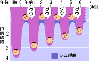 レム睡眠ノンレム睡眠