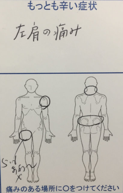 左肩痛の整体治療的な診断