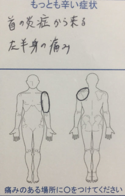 首の炎症痛みからくる左半身の痛みを整体治療で改善した一症例