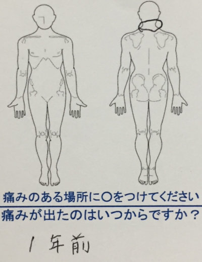 【首こりで他の整体院に行ってたが効果なし】近くの治療院を探して来院された40代女性