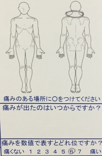 カイロでバキバキされて首が痛い【しびれあり】頚椎椎間板症と診断された30代女性