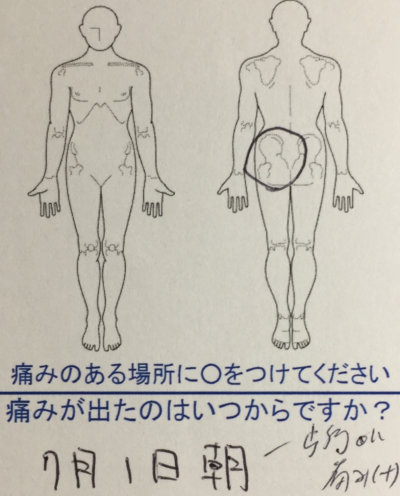 4日前にぎっくり腰発症【安静にするが治らない腰痛】改善した一症例