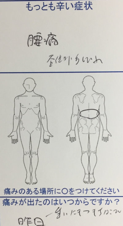 重い荷物を昨日持ってじわじわくるぎっくり腰【２回の整体施術で改善】一症例