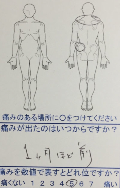 バレーボールで腰が痛い【歩いたり座ったりが辛い】整体治療でよくなった１症例