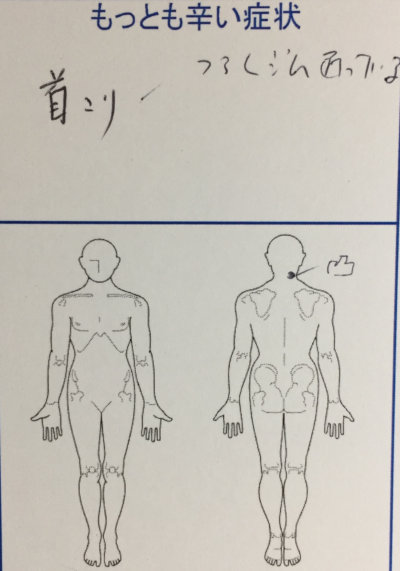 首肩の慢性的な凝り【頭痛や腕のしびれあり】30代男性の１症例