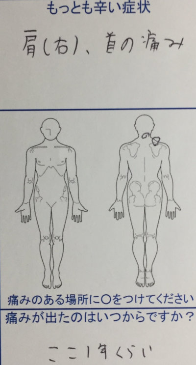 脱臼のクセで肩こり首の痛み【20代男性】他院で2,3日しか持たない症状がなくなった1症例