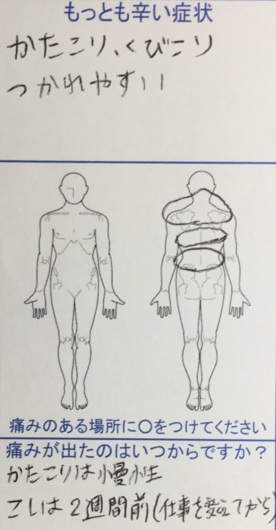 肩こり首コリ（慢性的）があり疲れやすく【2週間前から腰痛】30代女性の整体鍼灸治療の1症例