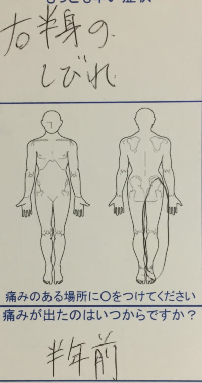 脚のしびれがきつく我慢できない【疼痛回避姿勢】ヘルニアで来院した30代男性の1症例