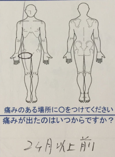 右足のつけ根の神経が痛い【2ヶ月前から】整体鍼灸治療で改善した1症例