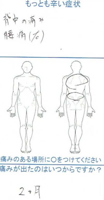 2ヶ月間背中と腰が痛い【腰の反りすぎが原因】2回の整体治療で改善した1症例