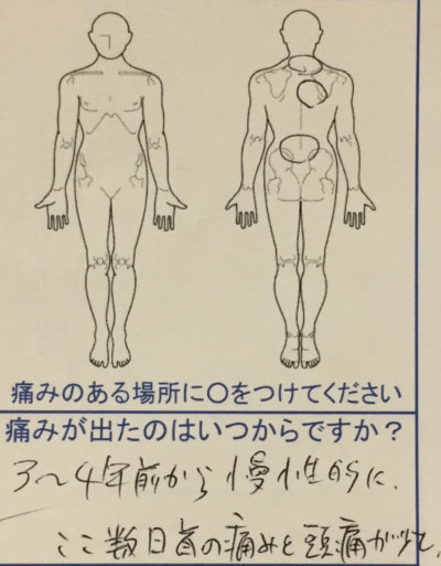 ここ数日首が痛く頭痛あり【3～4年前から慢性痛】アニメーター女性の1症例