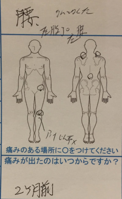 腰と左膝が痛い【50代主婦】の整体治療の1症例