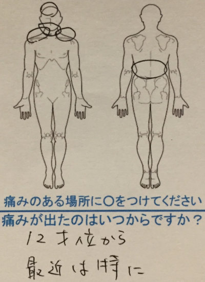 12歳頃から肩こり【最近は頭痛もする】30代女性の1症例