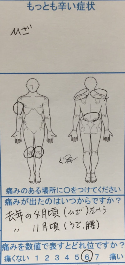 10代膝の痛み【成長痛？】膝から腰、腕まで痛かった1症例