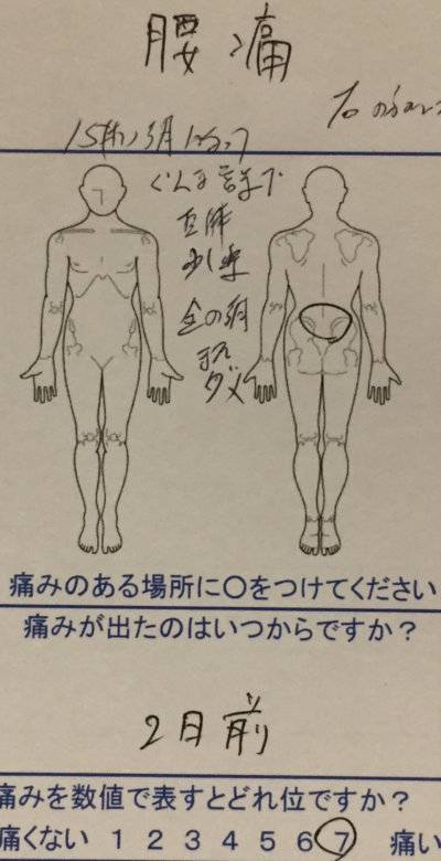 車運転多く腰痛【2日前にぎっくり腰】20代男性の1症例