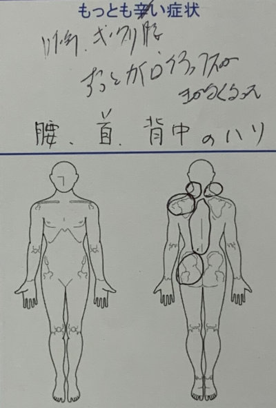 腰痛と首から背中にかけてのハリ【カイロが効かなくなった】40代女性の1症例