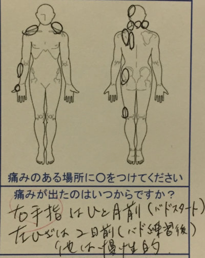 右手の痛み【背肩腰の張りから頭痛が慢性的】バドミントンで痛めた40代女性の1症例