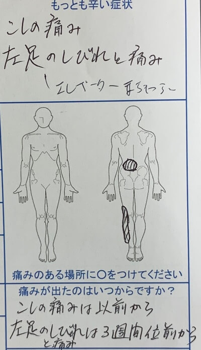 左足のしびれと痛み【腰の痛みあり】エレベーターを待てない程のしびれを訴えた50代男性の1症例