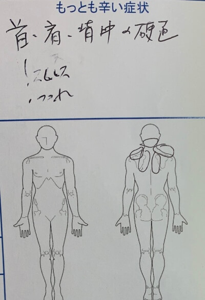 ストレスによる首肩背中の硬直【加味逍遥散服用中】40代女性の1症例