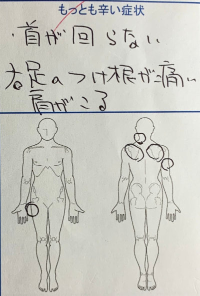 右半身の痛み【首・肩・腕】やしびれを整体鍼灸で改善した1症例