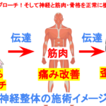 神経整体について
