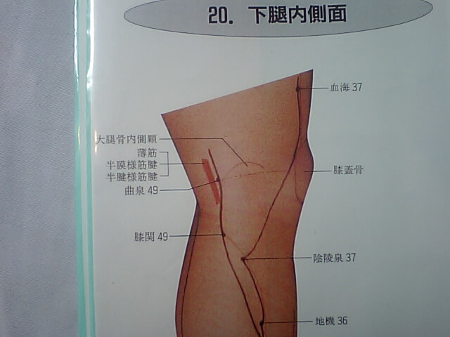 CA370095